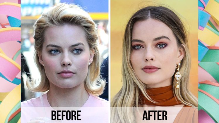 celebrity blepharoplasty before and after